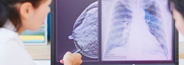 el uso de estos dispositivos intrauterinos con levonorgestrel y el riesgo de cáncer de mama